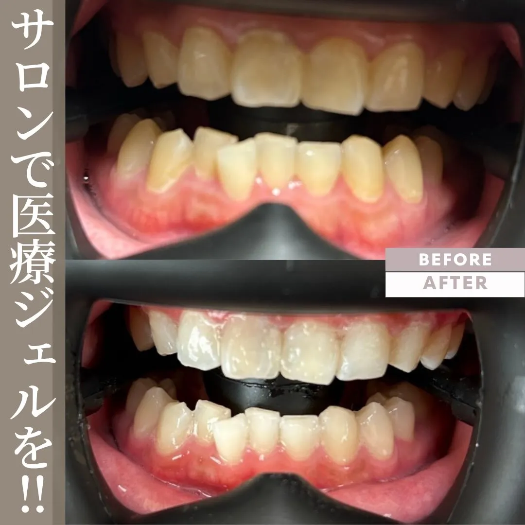 ✨ 結局、何が違うの? ✨